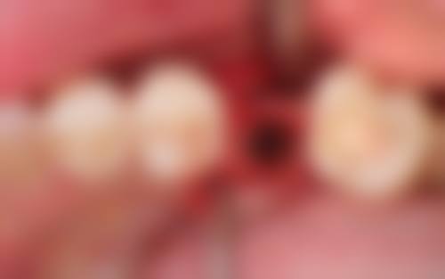 广州广大口腔牛海涛医生简介