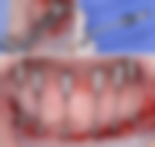 广州广大口腔牛海涛医生擅长项目