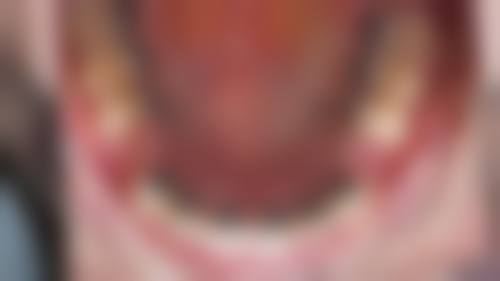 沧州市中 心医院庞杰医生的收费价格表