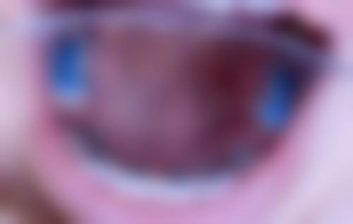 德州可恩口腔医院庞杰医生口碑评价