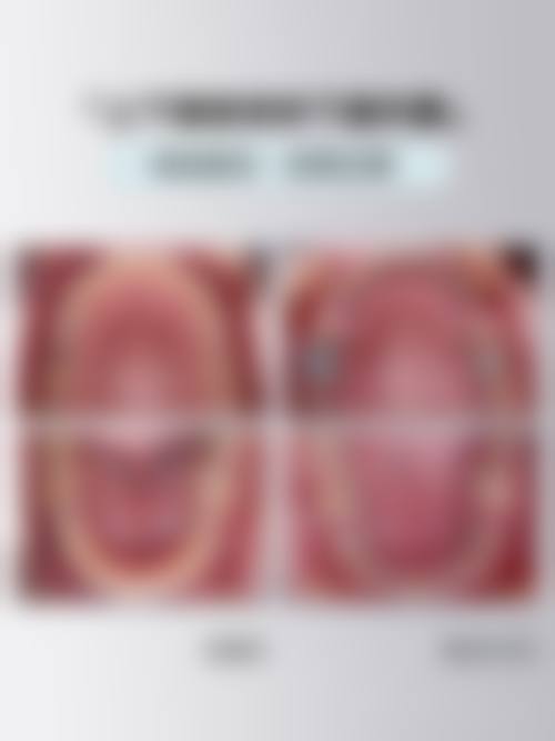 南方医 科 大学中医和西医结合医院庞杰医生擅长项目