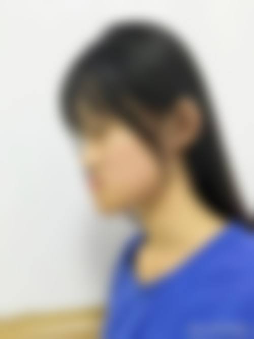 上海申洁口腔医院胡潇医生的收费价格表