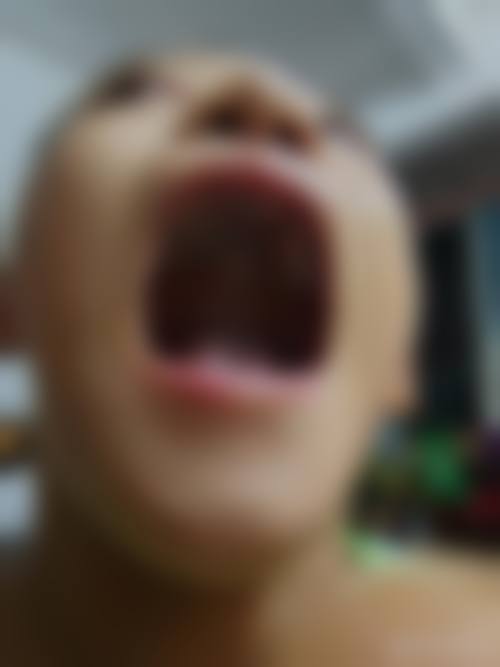 上海申洁口腔医院胡潇医生擅长项目