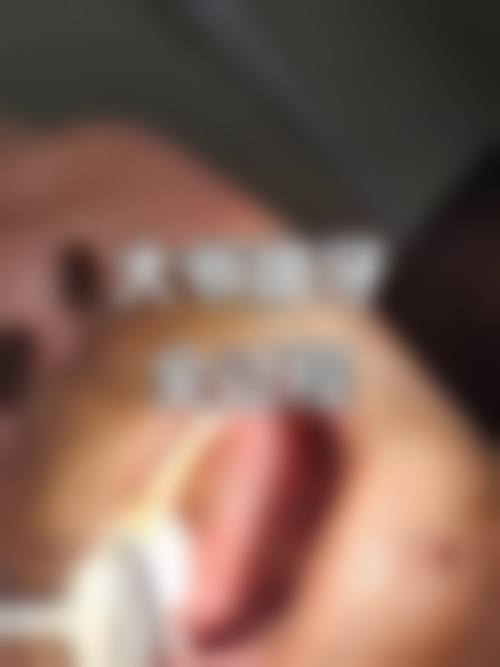 青岛大学附属医院牛海涛医生技术特色