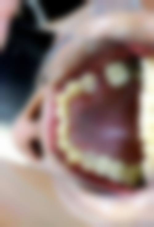 广州广大口腔牛海涛医生怎么预约挂号