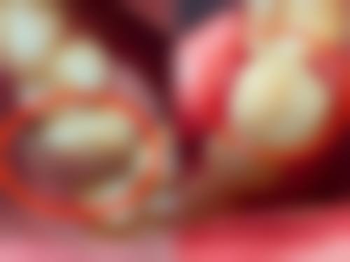 上海申洁口腔医院胡潇医生简介