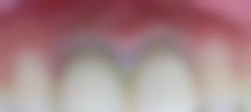 广州广大口腔牛海涛医生口碑评价