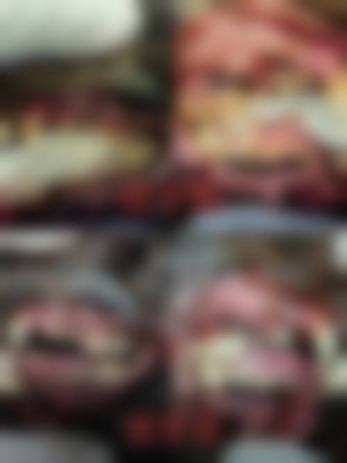 延安大学附属医院王剑飞医生的收费价格表