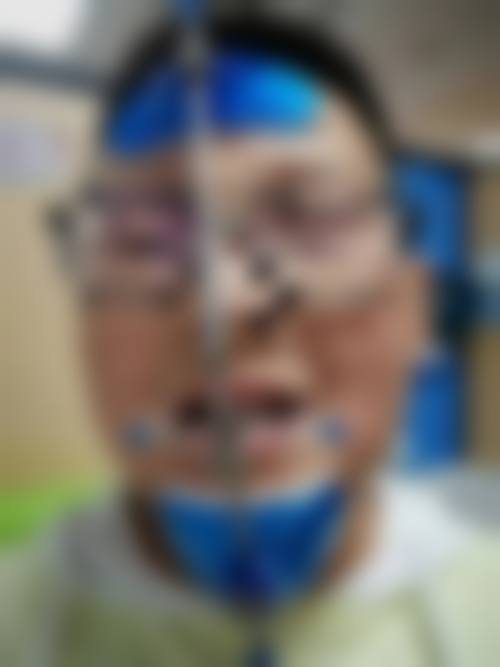 重庆巴南区人民医院杨正辉医生技术特色