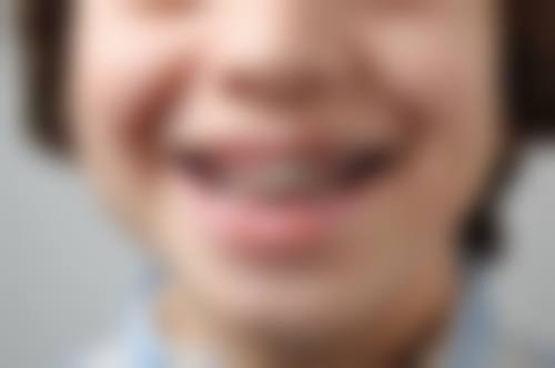 杭州佳尔仕口腔杨正辉医生口碑评价