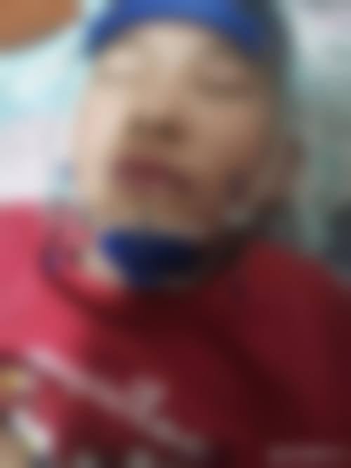 中日友好医院冯婧医生技术特色