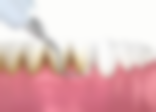 深圳悦之华口腔门诊部医院特色项目