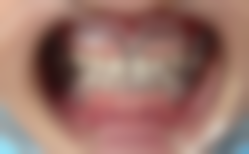 济南历城张记口腔医院预约方式