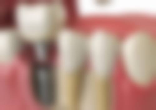 杭州亮贝美口腔医院郭庆医生口碑评价