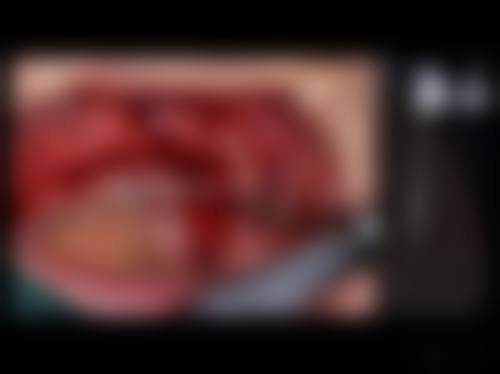 温岭东方医院杜文华医生擅长项目