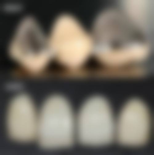 哈尔滨爱尔眼科医院郭庆医生口碑评价