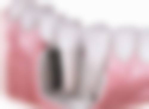 宁洱县人民医院武珊医生技术特色