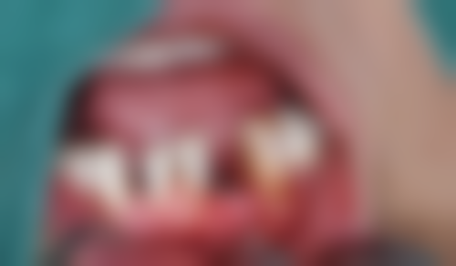 乐山齿安口腔诊所雷开英医生擅长项目