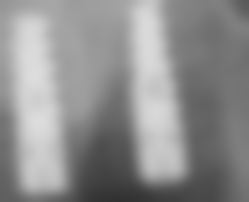 乐山齿安口腔诊所雷开英医生的收费价格表