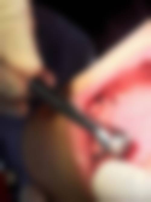 长沙雨花满意口腔门诊部满勇医生的收费价格表