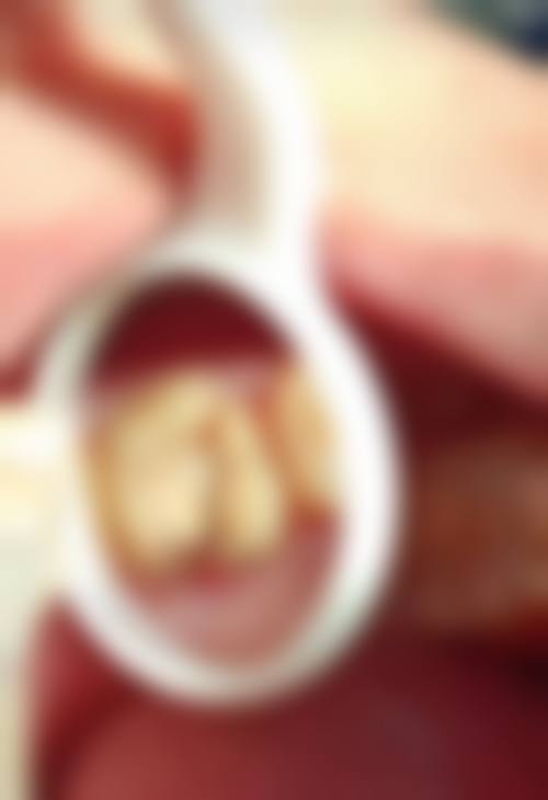 成都市第三人民医院王伟医生技术特色