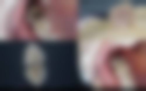 武汉斯启诺医疗美容门诊部王伟民医生技术特色