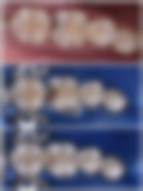 河北医 科 大学第一医院王伟医生的收费价格表