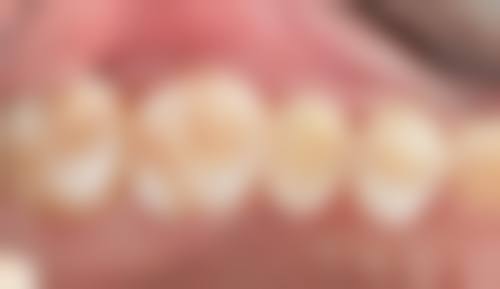 国内人民解放军总医院第五医学中 心王伟医生的收费价格表