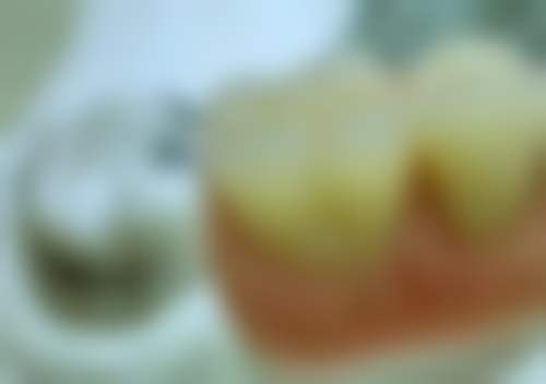 惠州爱尚口腔医院顾客的口碑评价