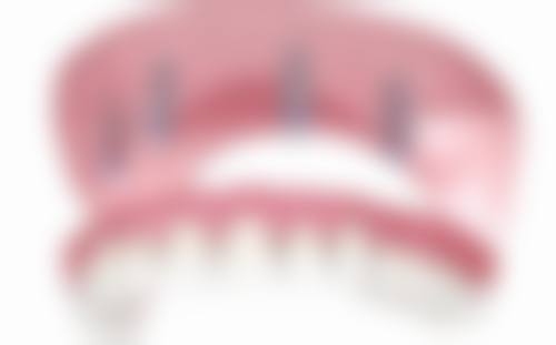 河南中 医 药大学第三附属医院修复科乔敏医生擅长项目