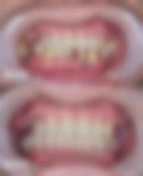 开封市中医院肝胆脾胃科乔敏医生的收费价格表