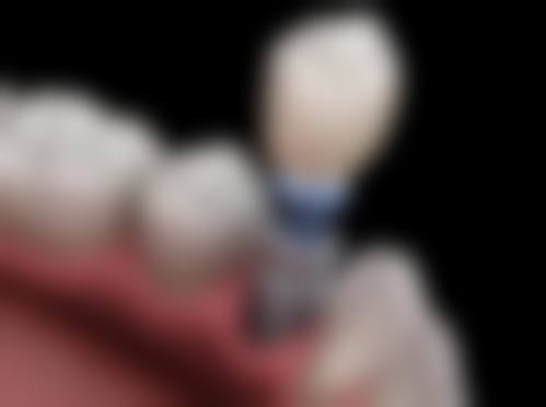 中日友好医院乔敏医生怎么预约挂号