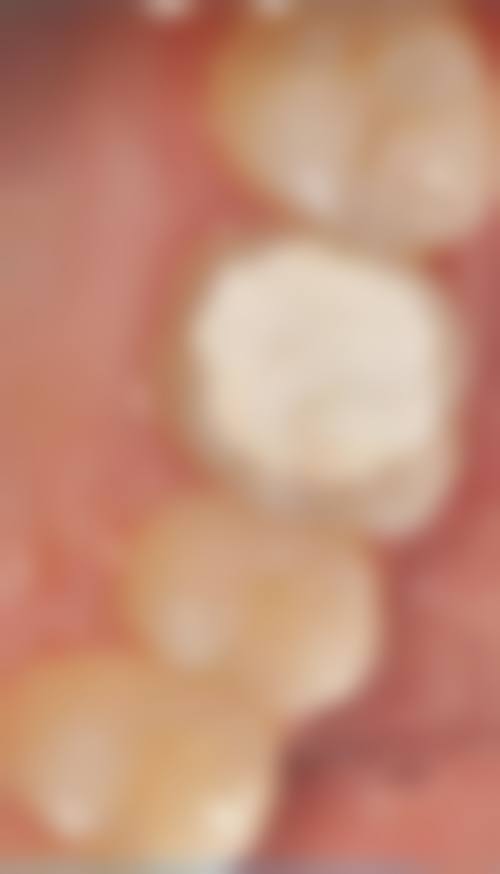 吉林市中 心医院王文宇医生技术特色