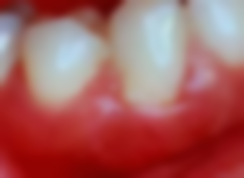 滨州贝佳口腔滨城口腔诊所医院预约方式