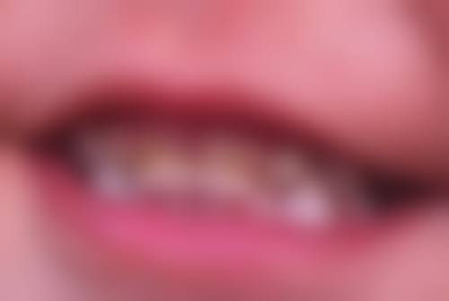 如皋牙博士口腔门诊部医院顾客的口碑评价