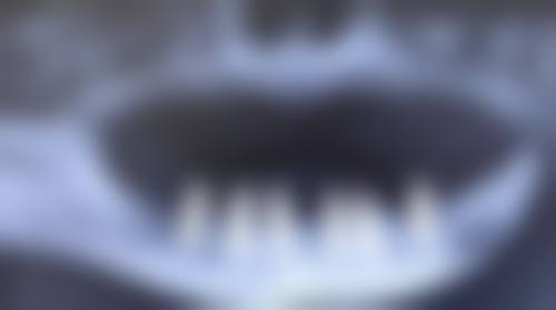 心理询问师王剑飞医生技术特色