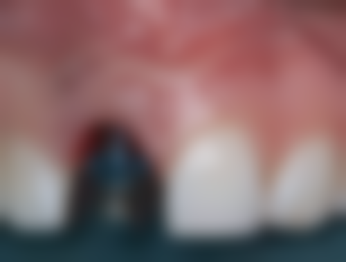 宁洱县人民医院武珊医生执业信息