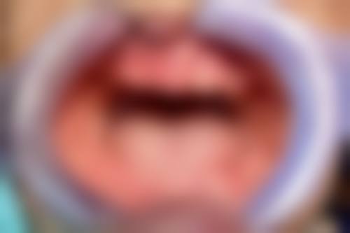 国内中医 科学 院广安门医院王剑飞（主事医师、博士生导师）医生口碑评价