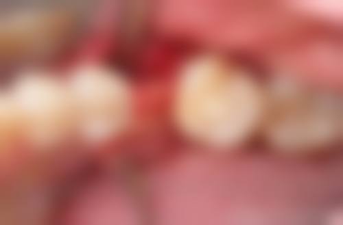 哈尔滨市周伟口腔门诊部王剑飞（种植医生）医生口碑评价