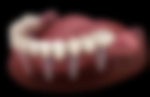 延安大学附属医院王剑飞（骨二科副主医师、副医生）医生简介