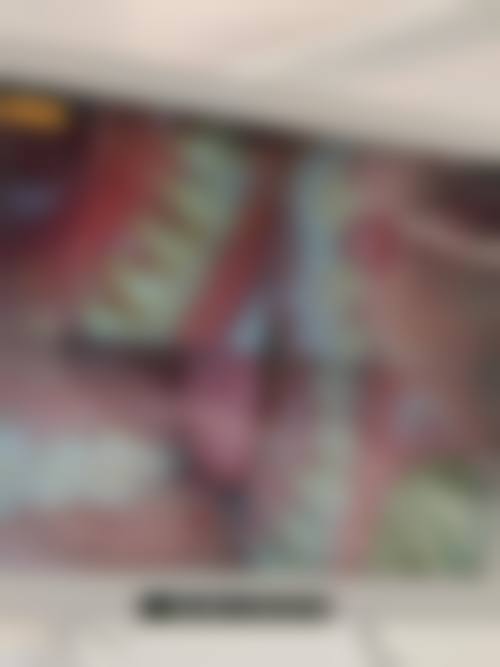 延安大学附属医院王剑飞（骨二科副主医师、副医生）医生擅长项目