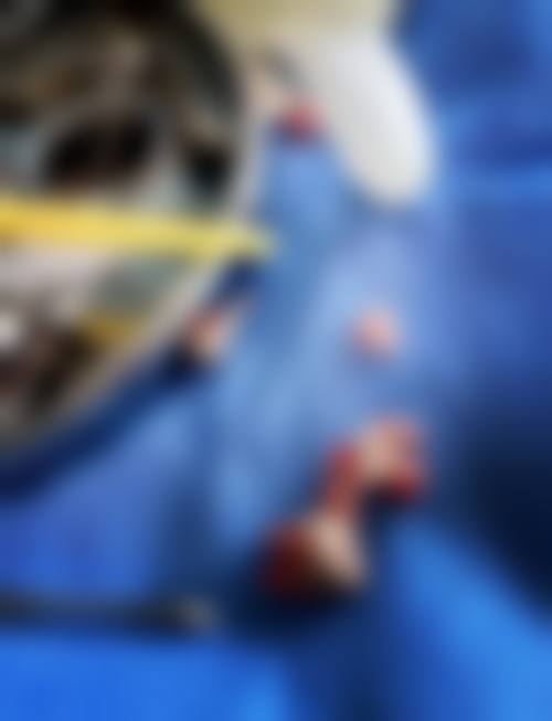 西咸院区武珊医生技术特色