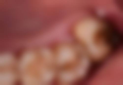 青岛卓凡口腔诊所医院预约方式