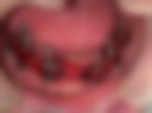 郑州德贝口腔李会龙医生口碑评价