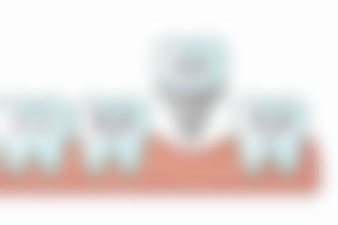 西安国际医学中心王爱武医生的收费价格表