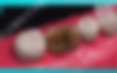 北京瑞泰口腔医院（双井店）王爱武医生技术特色