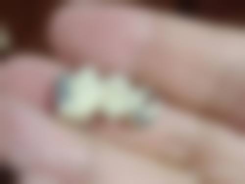 朔州市人民医院王爱武医生口碑评价