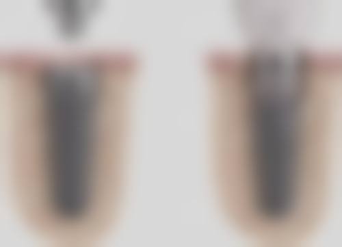 朔州市人民医院王爱武医生擅长项目