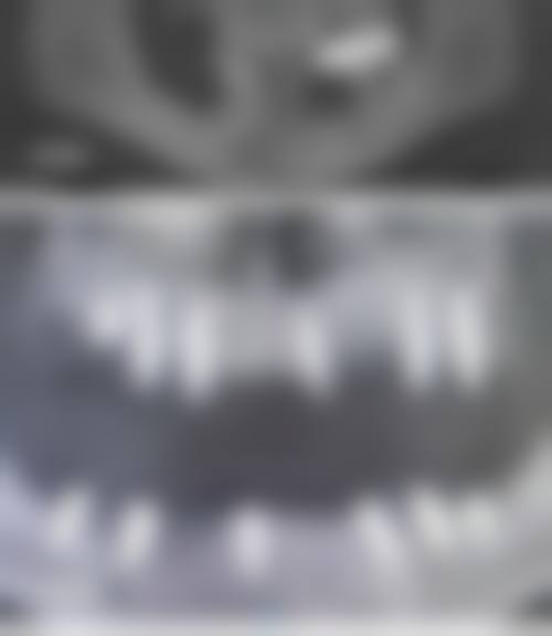 朔州市人民医院王爱武医生怎么预约挂号