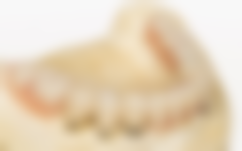 泗洪医院王全亮医生技术特色